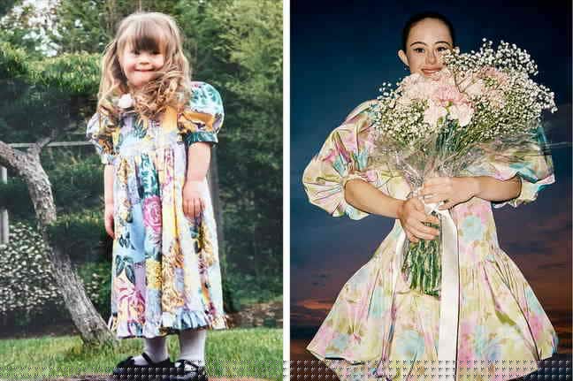 10 Potret Chelsea Werner, Penderita Down Syndrom yang Wujudkan Mimpinya Jadi Model dan Atlit